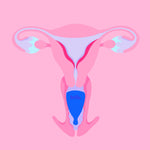 Cargar imagen en el visor de la galería, Copa menstrual Hello - Cérvix alto
